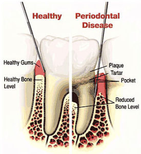Periodontics-Emergency-Dental-Treatment