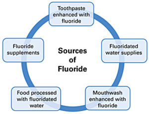 dental-fluoride-treatment